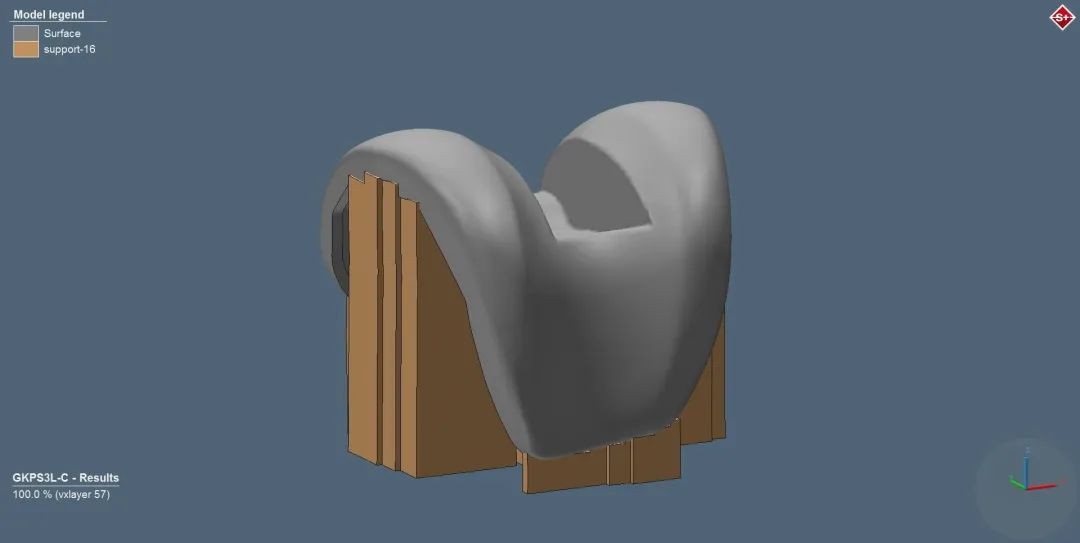 设计仿真 | Simufact Additive——3D打印仿真软件在医疗行业的应用