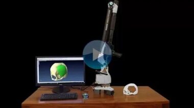 生产制造 | VISI逆向工程和建模技术助力患者颅骨再造