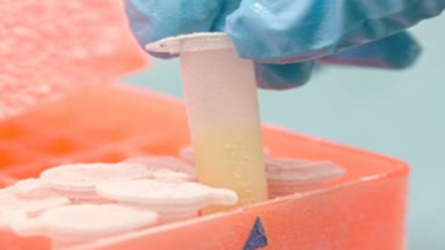 King’s Biobank 生物样本库管理系统：高效、智能的样本管理解决方案